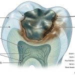 Can You Get a Cavity on a Filling? Signs You Shouldn't Ignore