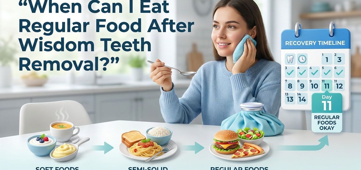 When Can I Eat Regular Food After Wisdom Teeth Removal