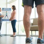 How to Prevent Varicose Veins: Simple Daily Habits for Healthier Legs